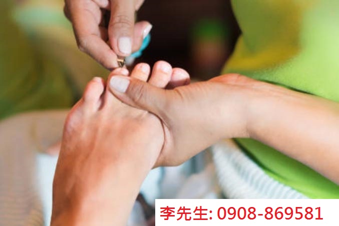 台北到府修腳皮修指甲(凍甲.嵌甲)